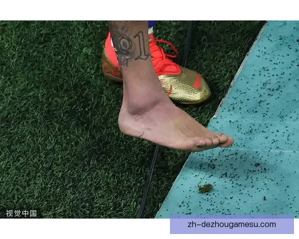 内马尔腿部失知觉引发关注 伤情原因与恢复情况成焦点 内马尔腿部失知觉引发关注 伤情原因与恢复情况成焦点
